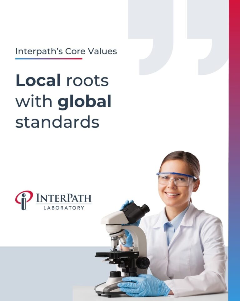 Local roots with global standards