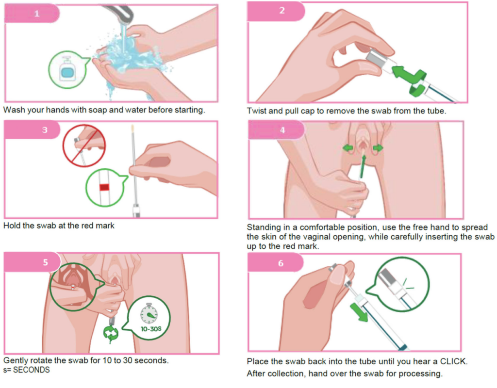 vaginal swab instructions