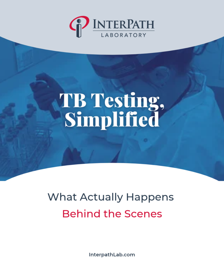 TB testing